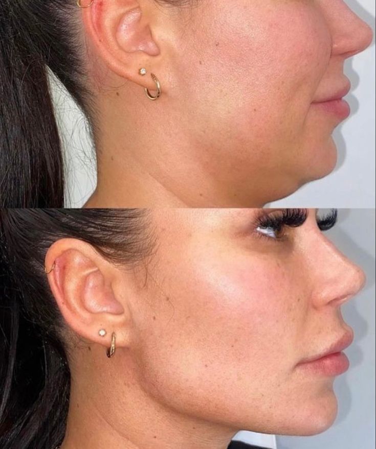 The Sculpt Secret